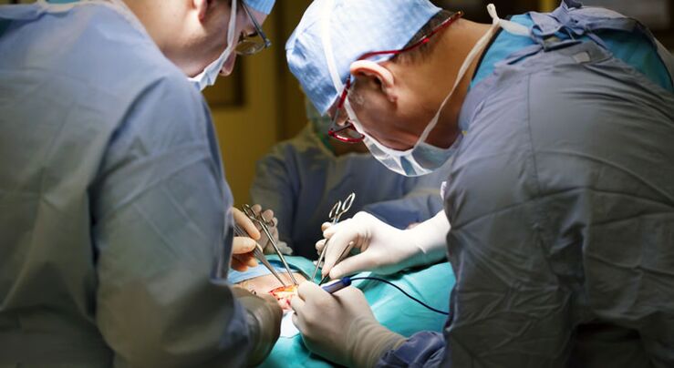 Bei Männern wird in fortgeschrittenen Stadien der chronischen Prostatitis eine Operation durchgeführt.